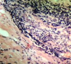 �������� ������������� ������� �����