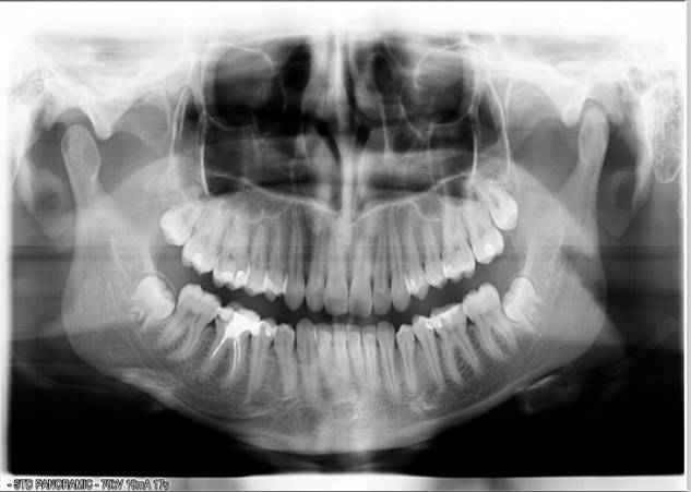 ���������� �