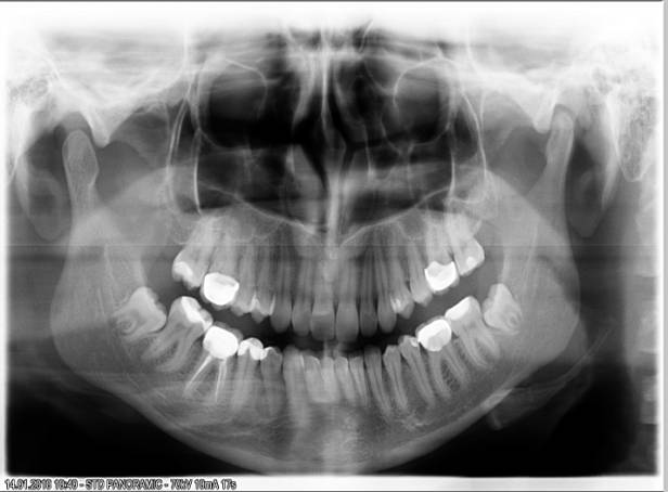 ���������� �