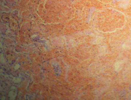 ����� � �������� 6