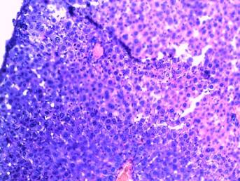 ïå÷åíü-ïåðåïîëíåíèå êðîâè.jpg