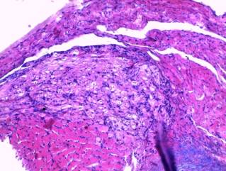 ñåðäöå-îòå÷íàÿ ñòðîìà.jpg