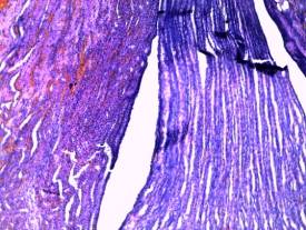 ïî÷êà-ïîëíîêðîâèå ìîçãîâîãî âåùåñòâà.jpg