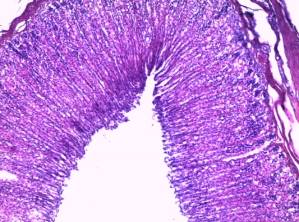 æåëóäîê-îðãàíû ïèùåâàðèò òðàêòà íèêàê íå îòðåàãèðîâàëè íà ââåäåíèå íàñòîÿ.jpg