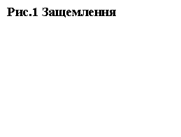 : .1 