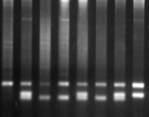 Gstm, Gstt, b-globin