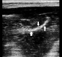 ��������: ��������: 1776KOR-���