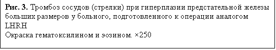 : . 3.   ()        ,     LHRH
   . ×250

