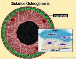 http://www.stomatologia.by/images/specialistam/implantologia/sovremennaya-koncepcia-osteointegracii/7.jpg