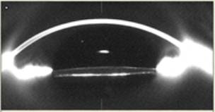 ���. 1. ���������� ����������� ����� ��������� �������� �����, ���������� ���������-��������� �Pentacam�. ����� ����������� ������ ����� ��������������� ������ ���