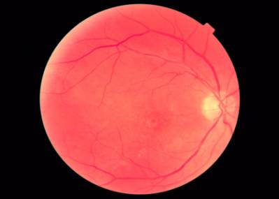 G:\�������� ���\��.��\2_20130925_145428_Non_myd_R_012.jpg