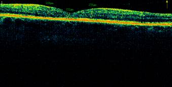 ��������: G:\�������� ���\_Protasov_I.A.__2510_Radial Lines_OS_2013-09-30_11-02-44_M_1942-02-12.jpg