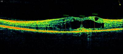 G:\�������� ���\_Protasov_I.A.__2510_Radial Lines_OD_2013-09-30_11-01-03_M_1942-02-12.jpg