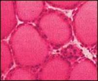 Щитовидная железа - гистологическая структура ткани