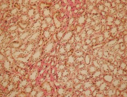 ����� �� �200