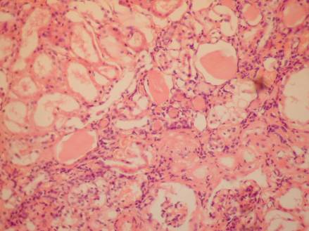 ����� �� �200 ����� � �������� ���������