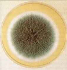 http://nsau.edu.ru/images/vetfac/images/ebooks/microbiology/stu/micol/pict/vozb4_1.jpg